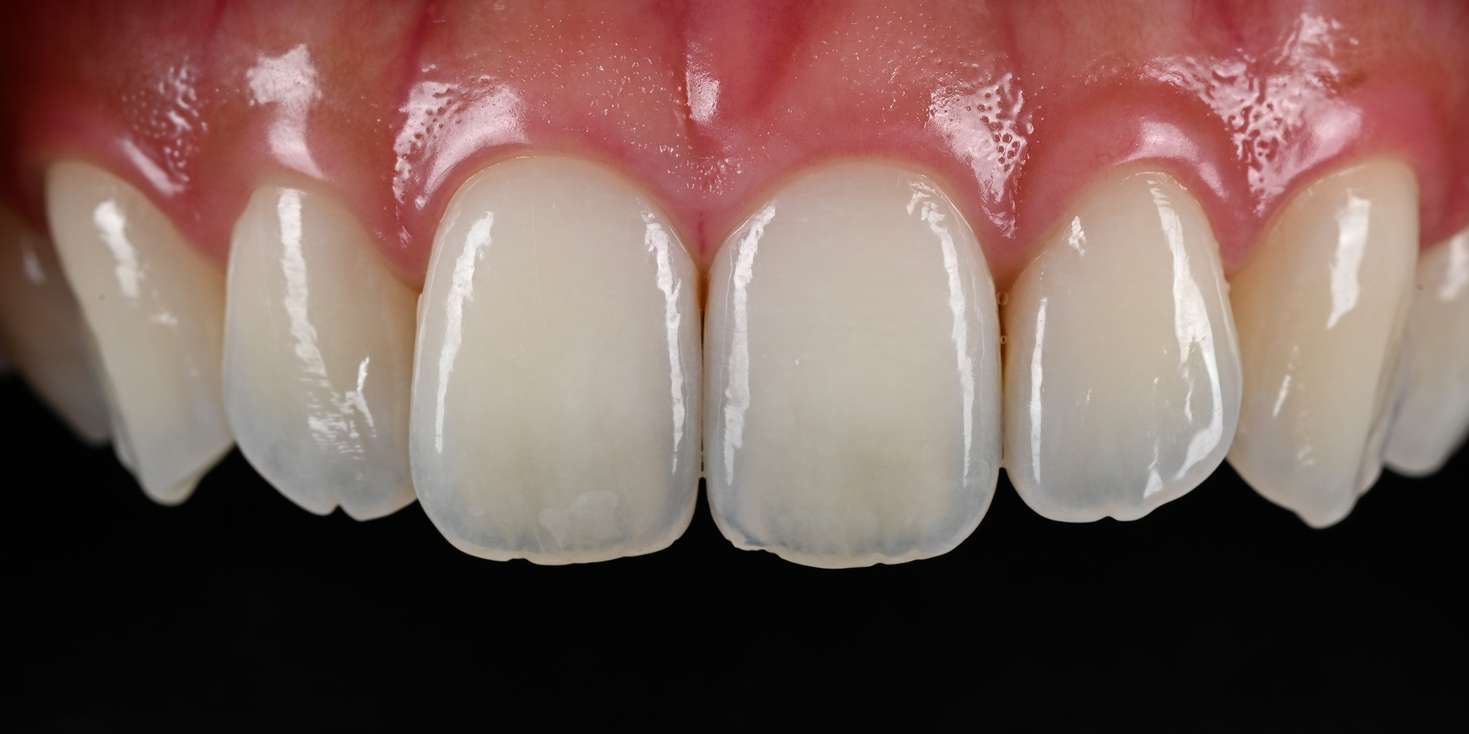 DENTÁLNÍ FOTOGRAFIE BEZ KOMPROMISŮ